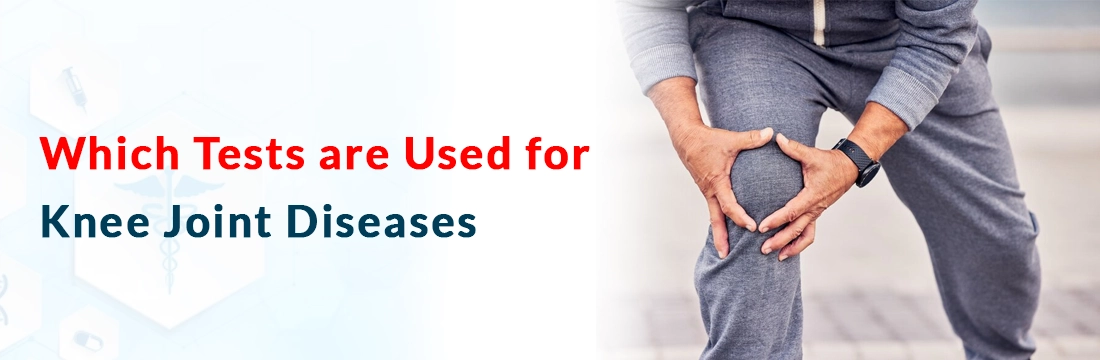  Which Tests are Used for Knee Joint Diseases